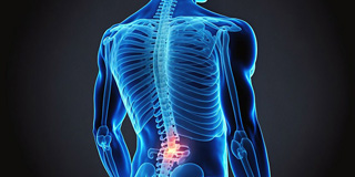 3d Image of Sciatica Pain treated at Legacy Chiropractic in Oklahoma City
